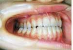 症例写真